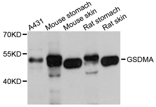 GSDMA Antibody - Western blot analysis of extracts of various cell lines, using Gsdma antibody at 1:1000 dilution. The secondary antibody used was an HRP Goat Anti-Rabbit IgG (H+L) at 1:10000 dilution. Lysates were loaded 25ug per lane and 3% nonfat dry milk in TBST was used for blocking. An ECL Kit was used for detection and the exposure time was 5s.