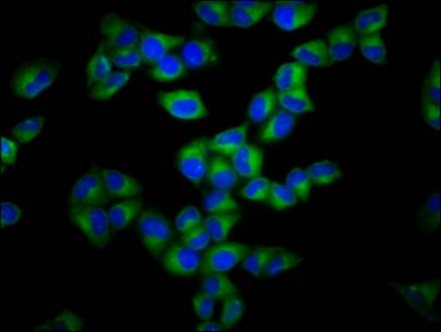 GSDMA Antibody - Immunofluorescence staining of Hela cells diluted at 1:133, counter-stained with DAPI. The cells were fixed in 4% formaldehyde, permeabilized using 0.2% Triton X-100 and blocked in 10% normal Goat Serum. The cells were then incubated with the antibody overnight at 4°C.The Secondary antibody was Alexa Fluor 488-congugated AffiniPure Goat Anti-Rabbit IgG (H+L).