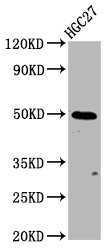 GSDMA Antibody - Western Blot Positive WB detected in: HGC27 whole cell lysate All Lanes: GSDMA antibody at 3.85µg/ml Secondary Goat polyclonal to rabbit IgG at 1/50000 dilution Predicted band size: 50 KDa Observed band size: 50 KDa