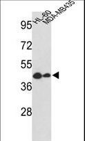 GSDMB / Gasdermin-Like Antibody - Western blot of GSDMB Antibody in HL-60, MDA-MB435 cell line lysates (35 ug/lane). GSDMB (arrow) was detected using the purified antibody.