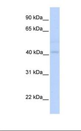 GSDMB / Gasdermin-Like Antibody - Fetal muscle lysate. Antibody concentration: 1.0 ug/ml. Gel concentration: 12%.  This image was taken for the unconjugated form of this product. Other forms have not been tested.