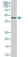 GSDMB / Gasdermin-Like Antibody - GSDML monoclonal antibody (M05), clone 1E10. Western blot of GSDML expression in A-431.