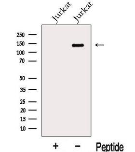 GSE1 / KIAA0182 Antibody - Western blot analysis of extracts of Jurkat cells using KIAA0182 antibody. The lane on the left was treated with blocking peptide.