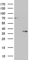 GSG1 Antibody - HEK293T cells were transfected with the pCMV6-ENTRY control. (Left lane) or pCMV6-ENTRY GSG1. (Right lane) cDNA for 48 hrs and lysed