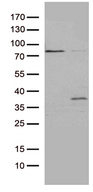 GSG1 Antibody - HEK293T cells were transfected with the pCMV6-ENTRY control. (Left lane) or pCMV6-ENTRY GSG1. (Right lane) cDNA for 48 hrs and lysed. Equivalent amounts of cell lysates. (5 ug per lane) were separated by SDS-PAGE and immunoblotted with anti-GSG1. (1:2000)