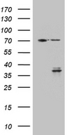 GSG1 Antibody - HEK293T cells were transfected with the pCMV6-ENTRY control. (Left lane) or pCMV6-ENTRY GSG1. (Right lane) cDNA for 48 hrs and lysed