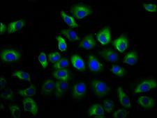 GSG1L Antibody - Immunofluorescence staining of A549 cells diluted at 1:66, counter-stained with DAPI. The cells were fixed in 4% formaldehyde, permeabilized using 0.2% Triton X-100 and blocked in 10% normal Goat Serum. The cells were then incubated with the antibody overnight at 4°C.The Secondary antibody was Alexa Fluor 488-congugated AffiniPure Goat Anti-Rabbit IgG (H+L).