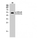 GSK3 Alpha+Beta Antibody - Western blot of Phospho-GSK3alpha/beta (Y279/216) antibody