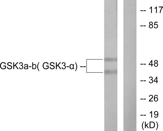 GSK3 Alpha+Beta Antibody - Western blot analysis of lysates from 293 cells, treated with TNF-a 20ng/ml 30', using GSK3 alpha/beta Antibody. The lane on the right is blocked with the synthesized peptide.