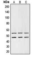 GSK3 Alpha+Beta Antibody - Western blot analysis of GSK3 alpha/beta expression in HEK293T (A); mouse liver (B); PC12 (C) whole cell lysates.