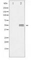 GSK3 Alpha+Beta Antibody - Western blot of GSK3 alpha/beta expression in TNF-a treated 293 whole cell lysates,The lane on the left is treated with the antigen-specific peptide.