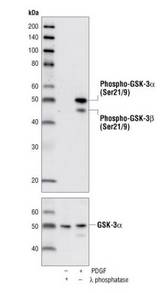 GSK3 Alpha+Beta Antibody - Western blot of extracts from COS-7 cells, lambda phosphatase- or PDGF-treated.