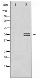 GSK3 Alpha+Beta Antibody - Western blot of GSK3 alpha/ beta phosphorylation expression in HeLa whole cell lysates,The lane on the left is treated with the antigen-specific peptide.