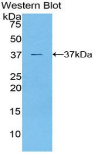 GSK3A / GSK3 Alpha Antibody - Western blot of recombinant GSK3A / GSK3 Alpha.  This image was taken for the unconjugated form of this product. Other forms have not been tested.