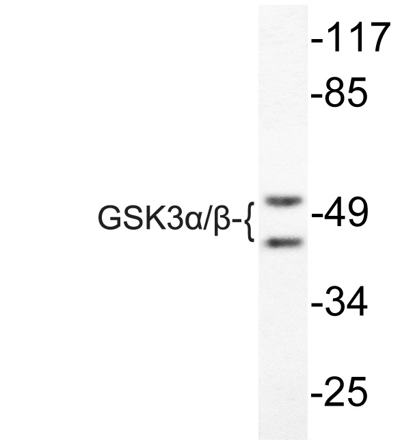 GSK3A / GSK3 Alpha Antibody - Western blot of GSK3/ (G273) pAb in extracts from 293 cells treated with TNF-a 20ng/ml 30mins.