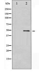 GSK3A / GSK3 Alpha Antibody - Western blot of GSK3 alpha expression in ovary cancer whole cell lysates,The lane on the left is treated with the antigen-specific peptide.