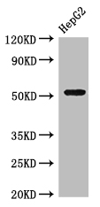 GSK3A / GSK3 Alpha Antibody - Western Blot Positive WB detected in: HepG2 whole cell lysate All lanes: GSK3A antibody at 3µg/ml Secondary Goat polyclonal to rabbit IgG at 1/50000 dilution Predicted band size: 51 kDa Observed band size: 51 kDa