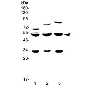 GSK3A / GSK3 Alpha Antibody - Western blot testing of 1) rat brain, 2) rat testis and 3) mouse testis lysate with GSK3 alpha antibody at 0.5ug/ml. Predicted molecular weight ~51 kDa.