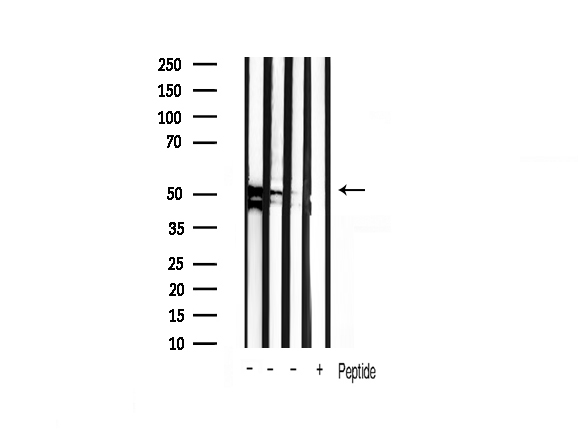 GSK3A / GSK3 Alpha Antibody - Western blot analysis of extracts of various cellslines using GSK3 alpha/beta antibody.