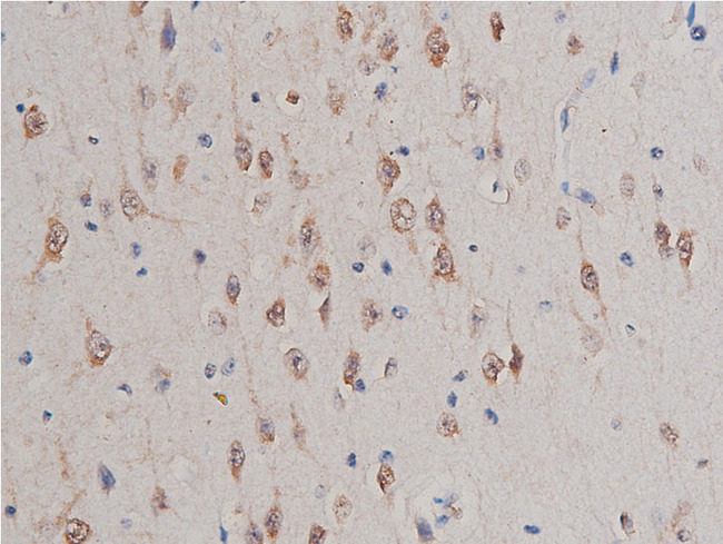 GSK3A / GSK3 Alpha Antibody - 1:50 staining human brain tissue by IHC-P. The tissue was formaldehyde fixed and a heat mediated antigen retrieval step in citrate buffer was performed. The tissue was then blocked and incubated with the antibody for 1.5 hours at 22°C. An HRP conjugated goat anti-rabbit antibody was used as the secondary.