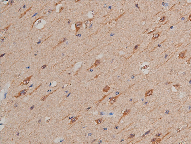 GSK3A / GSK3 Alpha Antibody - 1:50 staining human brain tissue by IHC-P. The tissue was formaldehyde fixed and a heat mediated antigen retrieval step in citrate buffer was performed. The tissue was then blocked and incubated with the antibody for 1.5 hours at 22°C. An HRP conjugated goat anti-rabbit antibody was used as the secondary.