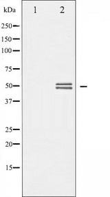 GSK3A / GSK3 Alpha Antibody - Western blot analysis of GSK3 alpha/beta expression in TNF-a treated 293 whole cells lysates. The lane on the left is treated with the antigen-specific peptide.