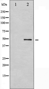 GSK3A / GSK3 Alpha Antibody - Western blot analysis of GSK3 alpha expression in ovarycarcinoma whole cells lysates. The lane on the left is treated with the antigen-specific peptide.