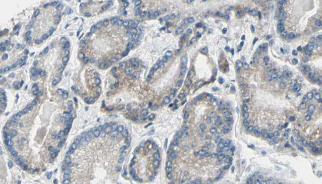 GSK3A / GSK3 Alpha Antibody - 1:100 staining human prostate tissue by IHC-P. The sample was formaldehyde fixed and a heat mediated antigen retrieval step in citrate buffer was performed. The sample was then blocked and incubated with the antibody for 1.5 hours at 22°C. An HRP conjugated goat anti-rabbit antibody was used as the secondary.