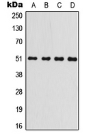 GSK3A / GSK3 Alpha Antibody - Western blot analysis of GSK3 alpha expression in Jurkat (A); HeLa (B); Raw264.7 (C); PC12 (D) whole cell lysates.