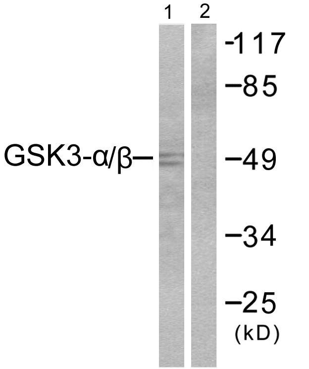 GSK3A / GSK3 Alpha Antibody - Western blot analysis of extracts from 293 cells, treated with TNF-a (20ng/ml, 30min), using GSK3a/ß (Ab-279/216) antibody ( Line 1 and 2).