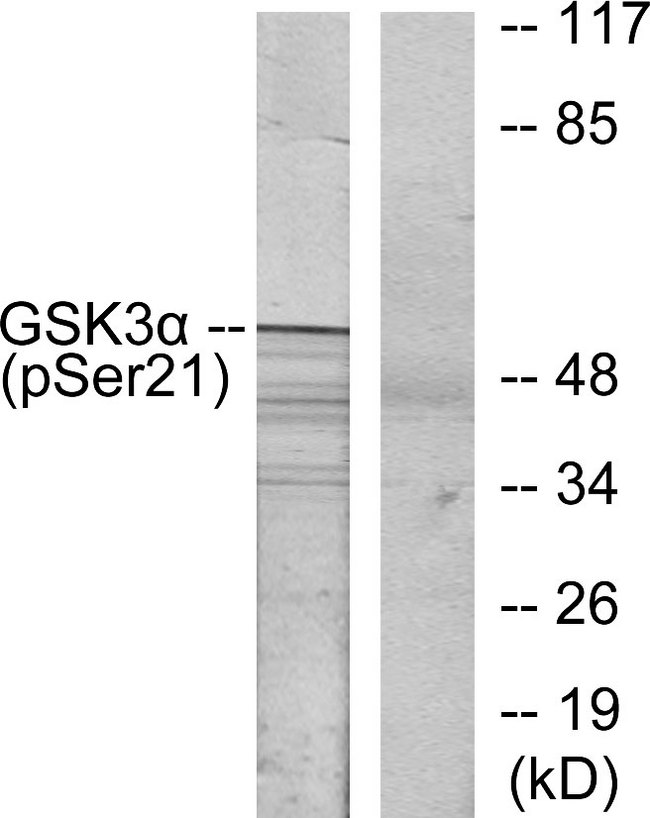 GSK3A / GSK3 Alpha Antibody - Western blot analysis of lysates from ovary cancer, using GSK3 alpha (Phospho-Ser21) Antibody. The lane on the right is blocked with the phospho peptide.