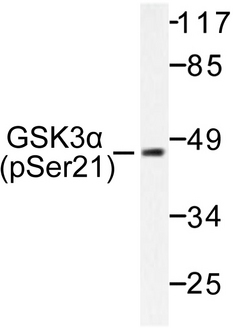 GSK3A / GSK3 Alpha Antibody - Western blot of p-GSK3 (S21) pAb pAb in extracts from ovary cancer.