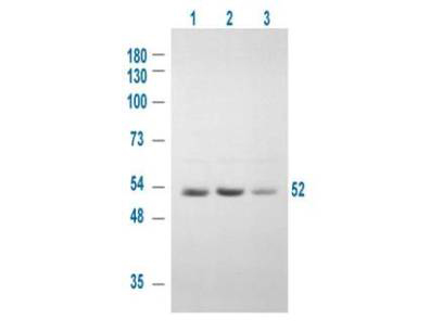 GSK3A / GSK3 Alpha Antibody - Anti-GSK3A Antibody - Western Blot. Western blot of Affinity Purified anti-GSK3A antibody shows detection of a 52 kD band corresponding to human GSK3A in various human derived 293T cell extracts. Cells were serum starved for 24 h. Lane 1: control, Lane 2: treated with IGF-1 (100 ng/ml) for 20 min, Lane 3: pre-treated with 10 uM LY294002 (selective PI3K inhibitor) and treated with IGF-1 (100 ng/ml) for 20 min. Lane 1 shows some baseline GSK3A reactivity that is intensified upon stimulation (lane2) and diminished when an inhibitor is added (lane 3). Approximately 20 ug of lysate was run on a SDS-PAGE and transferred onto nitrocellulose followed by reaction with a 1:1000 dilution of anti-GSK3A antibody. Signal was detected using standard techniques. Personal communication, Angela Carter, Experimental Therapeutics, Ontario Cancer Inst, Toronto, Canada.