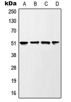 GSK3A / GSK3 Alpha Antibody - Western blot analysis of GSK3 alpha (pS21) expression in HEK293T UV-treated (A); mouse liver (B); rat liver (C); PC12 H2O2-treated (D) whole cell lysates.