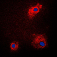 GSK3A / GSK3 Alpha Antibody - Immunofluorescent analysis of GSK3 alpha (pS21) staining in PC12 cells. Formalin-fixed cells were permeabilized with 0.1% Triton X-100 in TBS for 5-10 minutes and blocked with 3% BSA-PBS for 30 minutes at room temperature. Cells were probed with the primary antibody in 3% BSA-PBS and incubated overnight at 4 C in a humidified chamber. Cells were washed with PBST and incubated with a DyLight 594-conjugated secondary antibody (red) in PBS at room temperature in the dark. DAPI was used to stain the cell nuclei (blue).