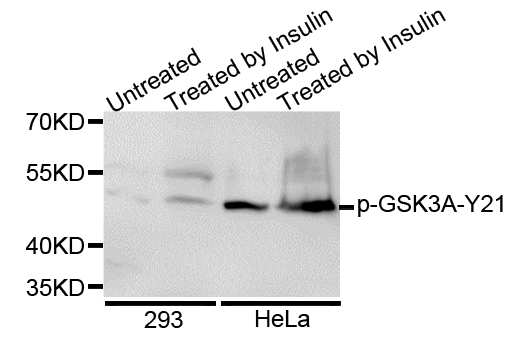 GSK3A / GSK3 Alpha Antibody - Western blot analysis of extracts of various cell lines.