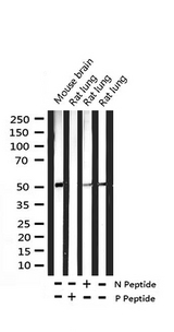 GSK3A / GSK3 Alpha Antibody - Western blot analysis of Phospho-GSK3 alpha (Ser21) expression in various lysates