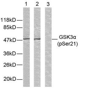 GSK3A / GSK3 Alpha Antibody - Western blot analysis of extracts from ovary cancer cells. Line1: Using GSK3a(Phospho-Ser21) Antibody; Line2: The same antibody preincubated with synthesized non-phospho- peptide; Line3: The same antibody preincubated with synthesized phosphopeptide.