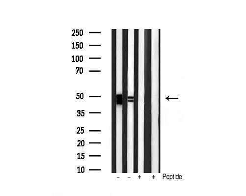 GSK3A / GSK3 Alpha Antibody - Western blot analysis of extracts of various cellslines using Phospho-GSK3 alpha/beta (Tyr279/216) antibody 