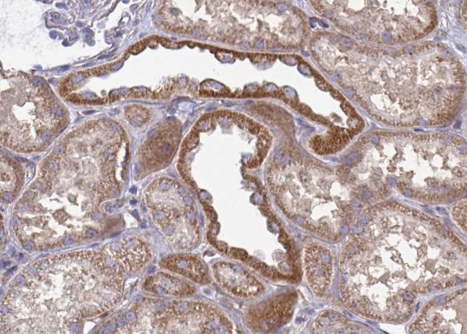 GSK3A / GSK3 Alpha Antibody - 1:50 staining human kidney tissue by IHC-P. The tissue was formaldehyde fixed and a heat mediated antigen retrieval step in citrate buffer was performed. The tissue was then blocked and incubated with the antibody for 1.5 hours at 22°C. An HRP conjugated goat anti-rabbit antibody was used as the secondary.