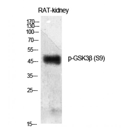 GSK3B / GSK3 Beta Antibody - Western blot of Phospho-GSK3beta (S9) antibody