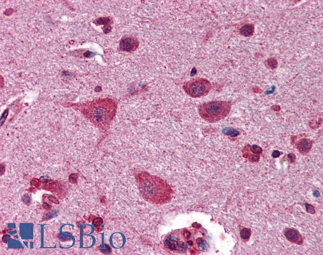 GSK3B / GSK3 Beta Antibody - Anti-GSK3B / GSK3 Beta antibody IHC of human brain, cortex. Immunohistochemistry of formalin-fixed, paraffin-embedded tissue after heat-induced antigen retrieval. Antibody concentration 2.5 ug/ml.  This image was taken for the unconjugated form of this product. Other forms have not been tested.