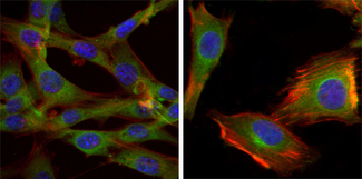 GSK3B / GSK3 Beta Antibody - Immunofluorescence of NIH/3T3 (left) and U251 (right) cells using GSK3B mouse monoclonal antibody (green). Blue: DRAQ5 fluorescent DNA dye. Red: Actin filaments have been labeled with Alexa Fluor-555 phalloidin.