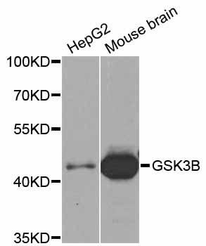 GSK3B / GSK3 Beta Antibody - Western blot analysis of extracts of various cell lines.