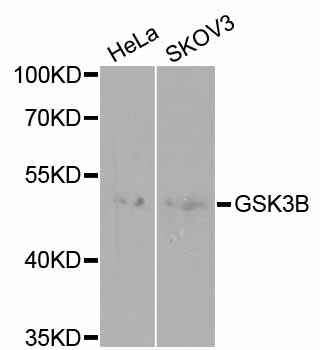 GSK3B / GSK3 Beta Antibody - Western blot analysis of extracts of various cell lines.