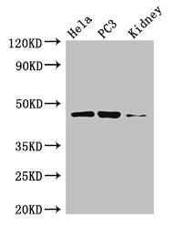 GSK3B / GSK3 Beta Antibody - Western Blot Positive WB detected in: Hela whole cell lysate, PC-3 whole cell lysate, Mouse kidney tissue All lanes: GSK3B antibody at 3µg/ml Secondary Goat polyclonal to rabbit IgG at 1/50000 dilution Predicted band size: 47, 49 kDa Observed band size: 47 kDa