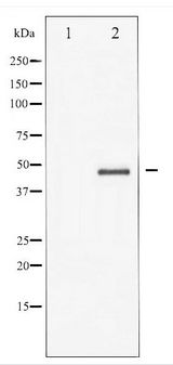 GSK3B / GSK3 Beta Antibody - Western blot of GSK3 beta expression in HeLa whole cell lysates,The lane on the left is treated with the antigen-specific peptide.