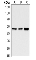 GSK3B / GSK3 Beta Antibody - Western blot analysis of GSK3 beta expression in Hela (A), mouse testis(B), rat brain (C) whole cell lysates.