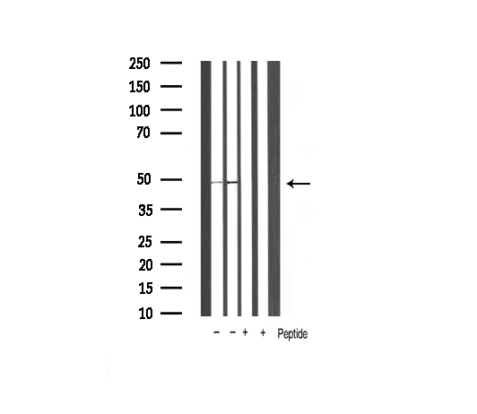 GSK3B / GSK3 Beta Antibody - Western blot analysis of extracts of various sample using GSK3B antibody.