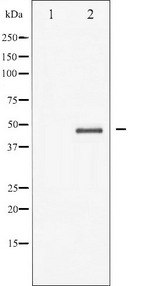 GSK3B / GSK3 Beta Antibody - Western blot analysis of GSK3 beta expression in HeLa whole cells lysates. The lane on the left is treated with the antigen-specific peptide.